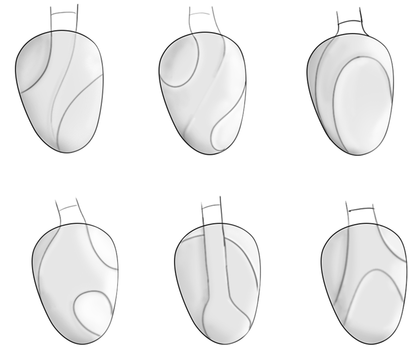 Earcup form iterations, six variants
